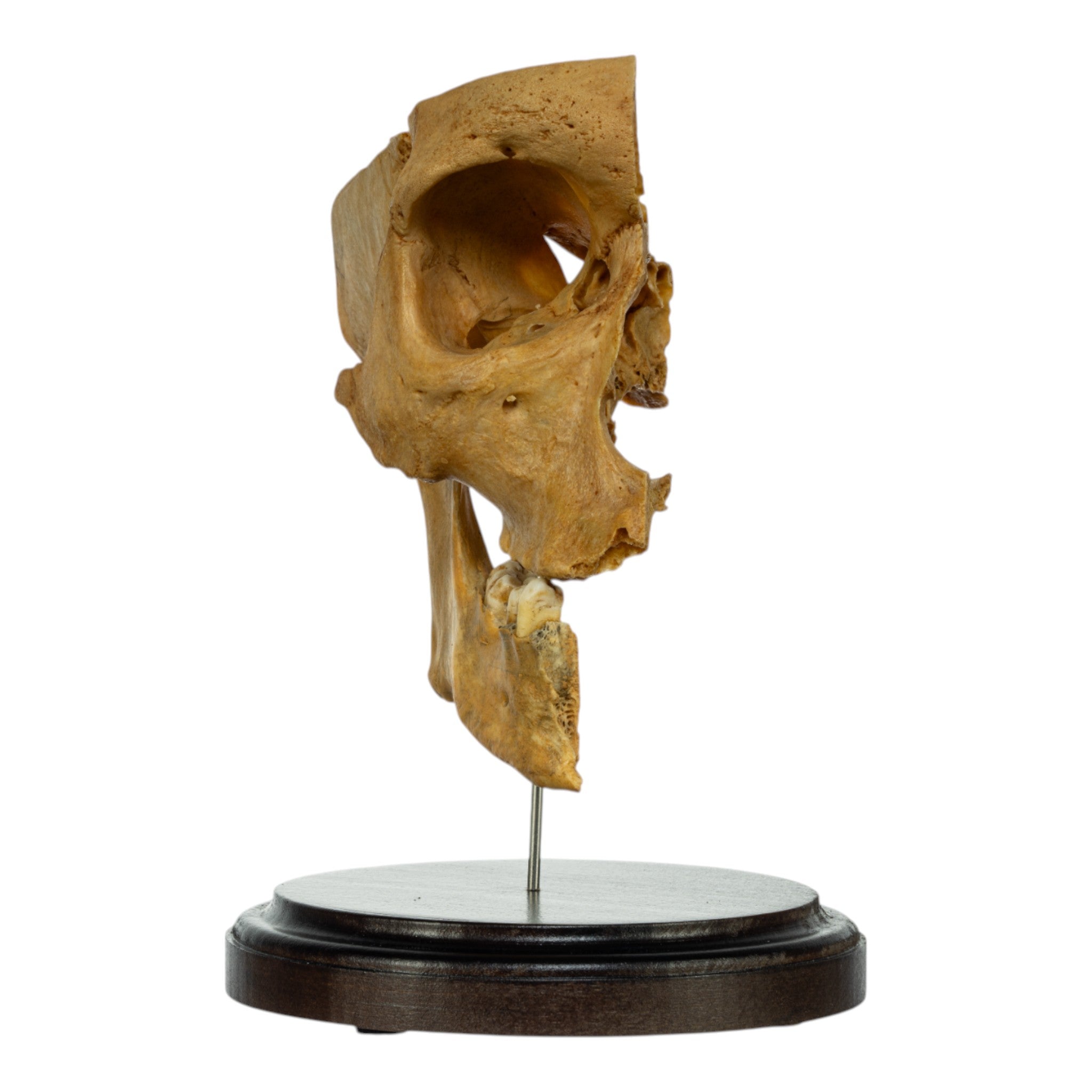 Real Human Partial Skull on Stand - Anatomical Model for Medical Study, Halloween Decor & Gothic Display - Perfect for Education, Science Classrooms & Spooky Home Decor