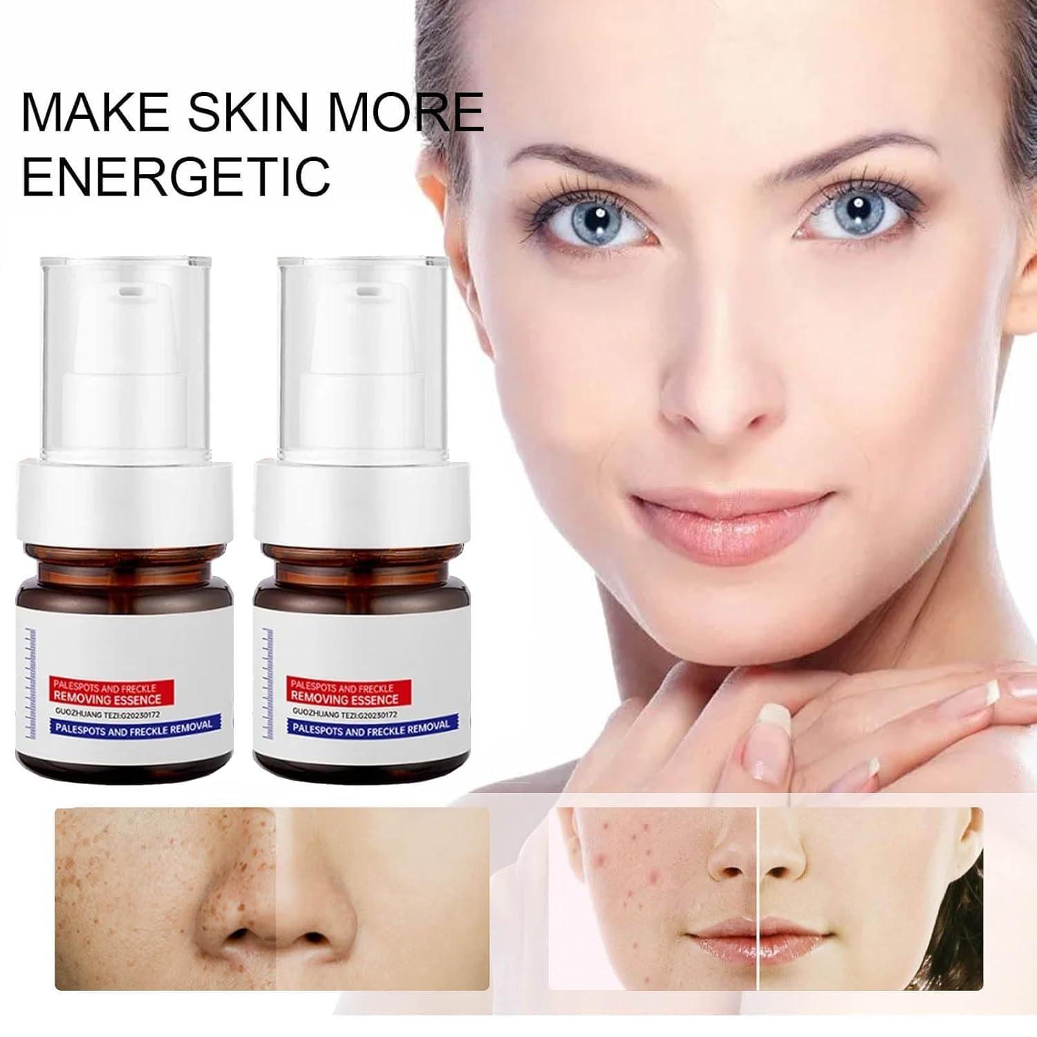30ml Vitamin C Brightening Serum for Dark Spots & Hyperpigmentation – Anti-Aging Face Serum with Essence Removal (2 Pack) – Perfect for Daily Skincare Routine & Nighttime Treatment