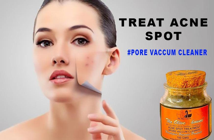 Olive Shower Acne Spot Treatment - Pore Vacuum Cleaner for Acne-Prone Skin, 50g Pack | Perfect for Daily Skincare & Blemish Control