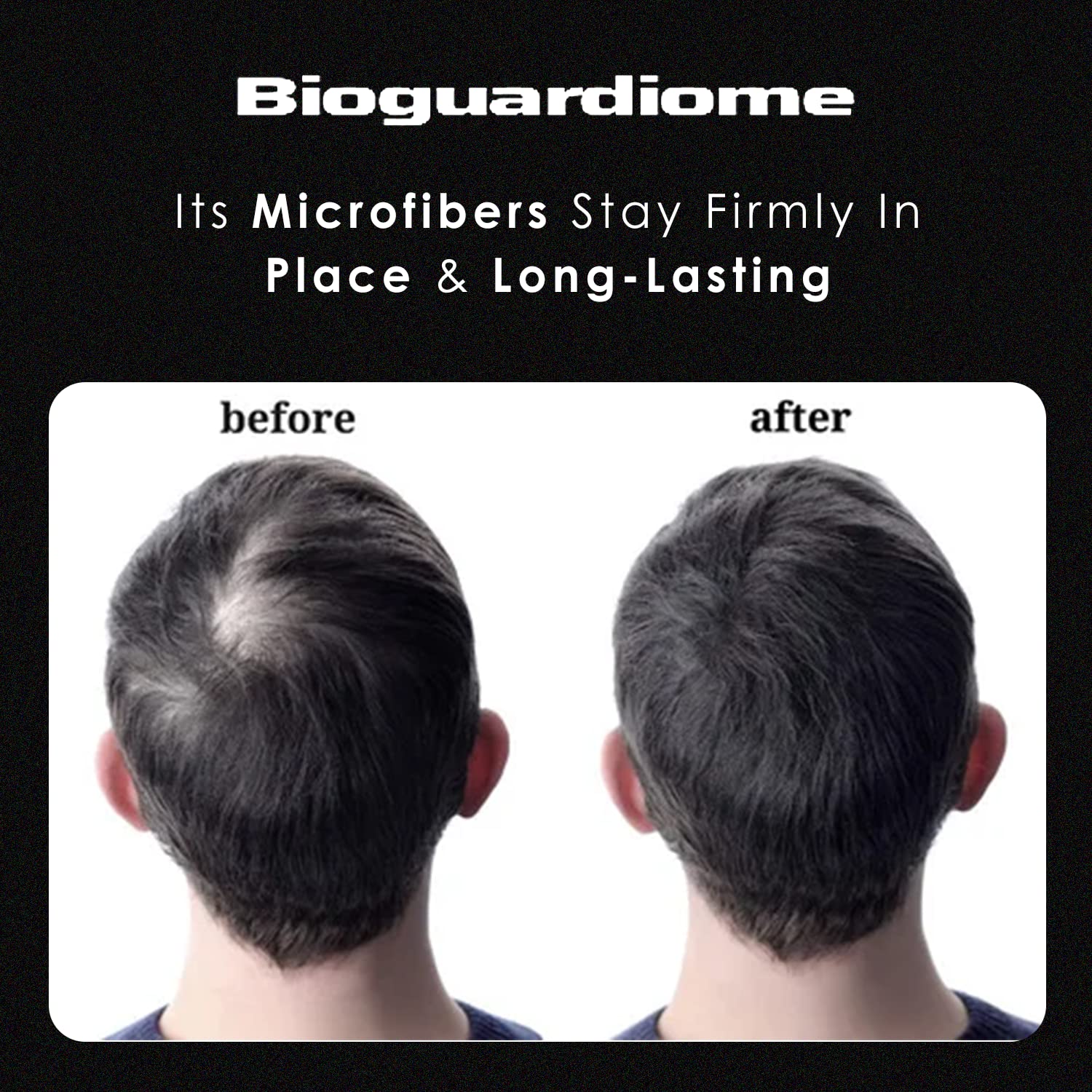 Bioguardiome All Hair Building Fiber Refill Bag - 25gm Black Powder-Based Hair Thickening Fibers for Thinning Hair | Instant Volume & Natural Look | Great for Daily Use, Special Occasions & Confidence Boosting