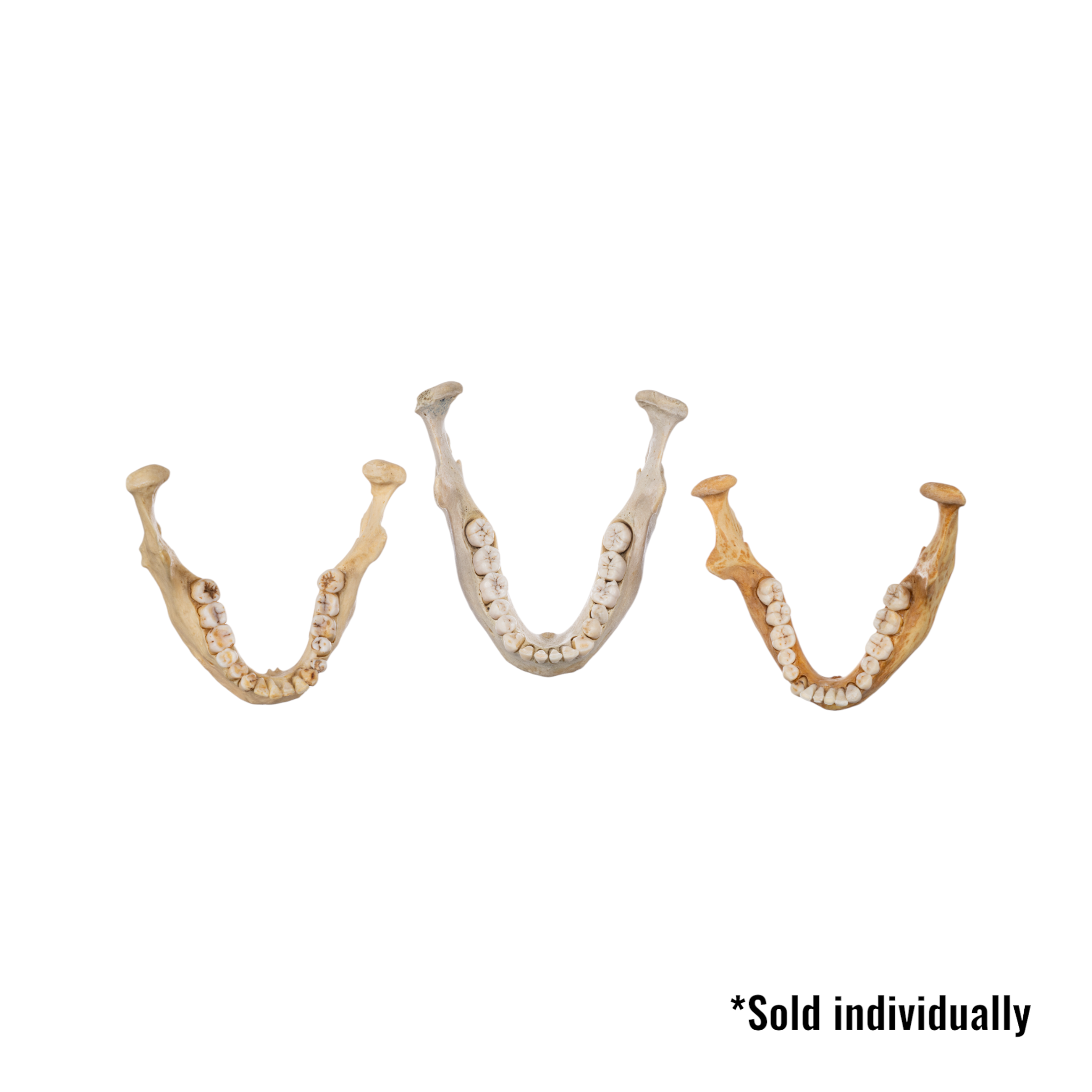 Authentic Human Mandible Bone - Single Specimen for Medical Study, Dental Education & Anatomy Research