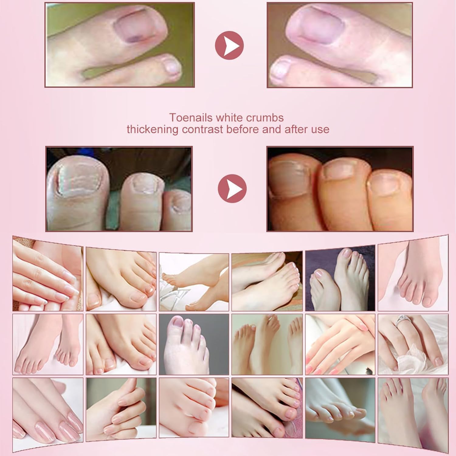 2PCS Herbal Nail Treatment Essence Kit - Oedo & Rosabelle Nail Strengthening Oil for Weak, Brittle & Damaged Nails - At-Home Nail Care Solution for Salon-Quality Results - Perfect for DIY Manicures & Nail Repair