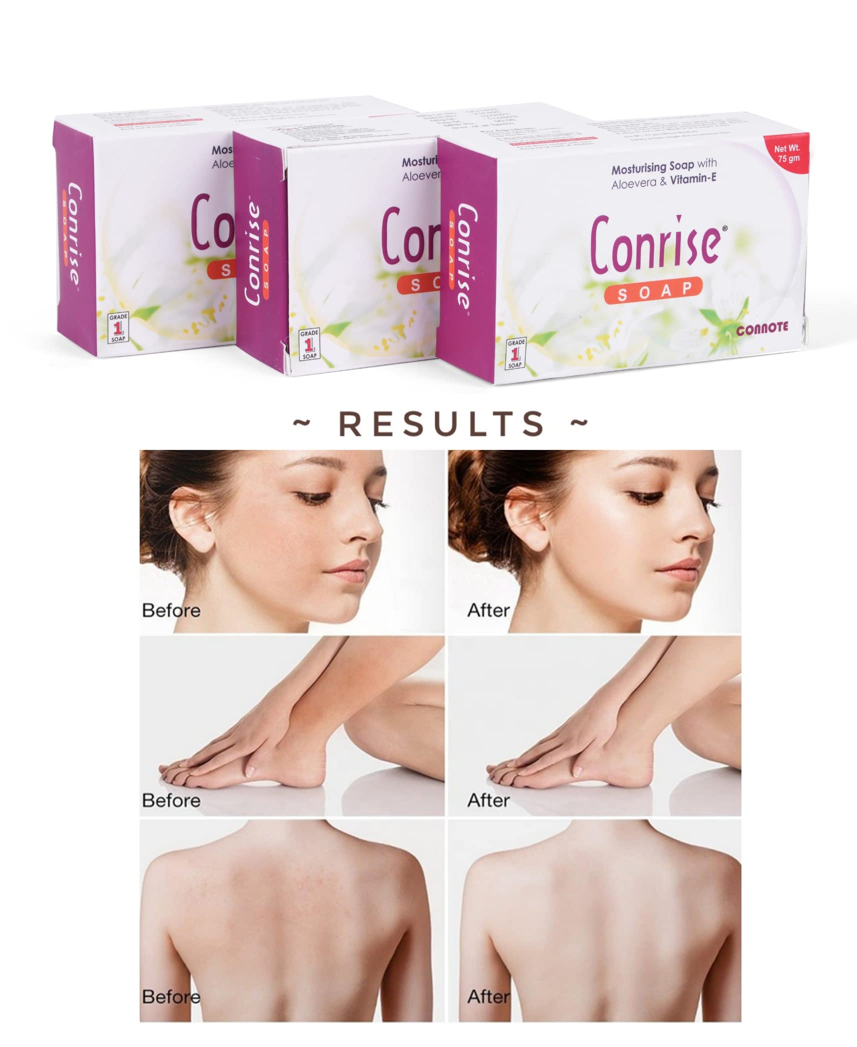Conrise Original Moisturising Grade-1 Soap With Aloe Vera & Vitamin E - 75g (Pack of 3) - Gentle Cleansing for Dry & Sensitive Skin - Perfect for Daily Face & Body Care