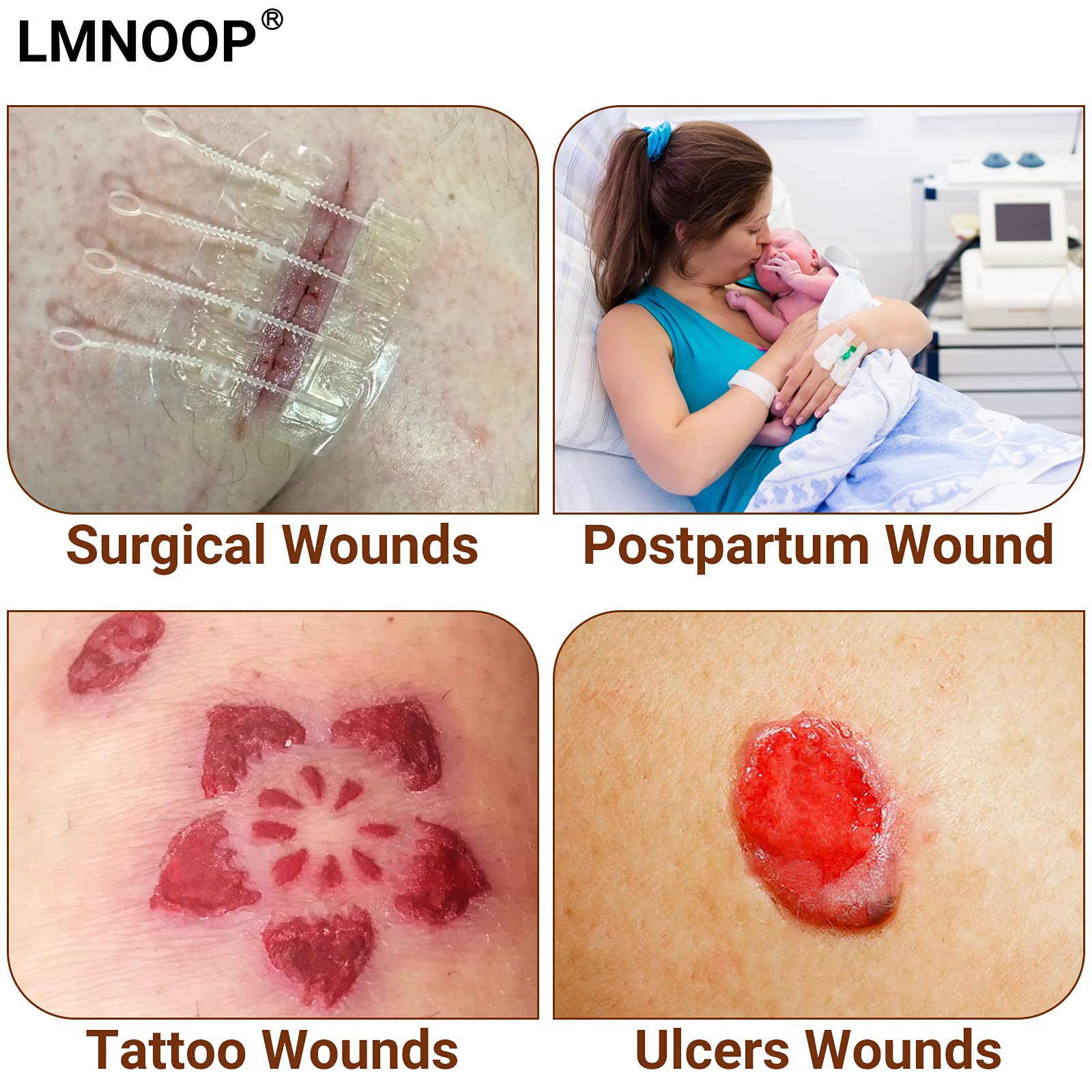 LMNOOP® Advanced Wound Care Cream - Healing Ointment for Cuts, Burns, Scrapes, Bites & Surgical Wounds | Antibacterial Skin Repair Treatment for Pressure Sores & Ulcers | First Aid Essential for Home, Hospital & Travel Use