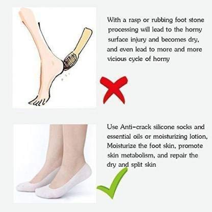 KPS Anti Crack Full Length Silicone Foot Protector Moisturizing Socks for Dry Cracked Feet & Heel Care - Pain Relief Gel Socks for Men & Women - Non-Slip Design - Ideal for Overnight Foot Treatment, Diabetic Foot Care & Post-Pedicure Use (1 Pair)