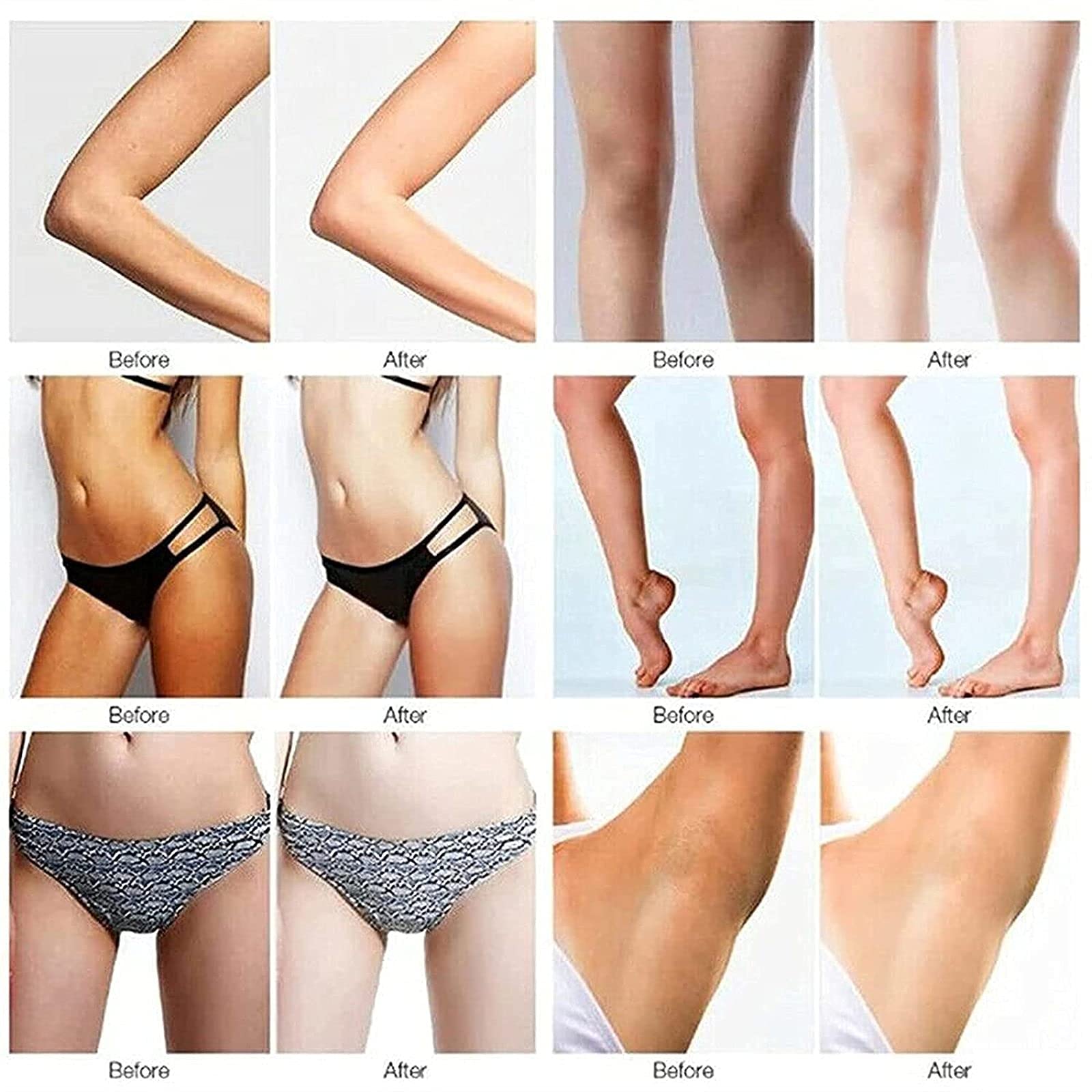2 Pcs Whitening & Lightening Cream for Underarms, Knees, Elbows - Skin Brightening & Bleaching Treatment - Dark Spot Corrector for Smooth Even Tone - Perfect for Daily Body Care & Sensitive Areas