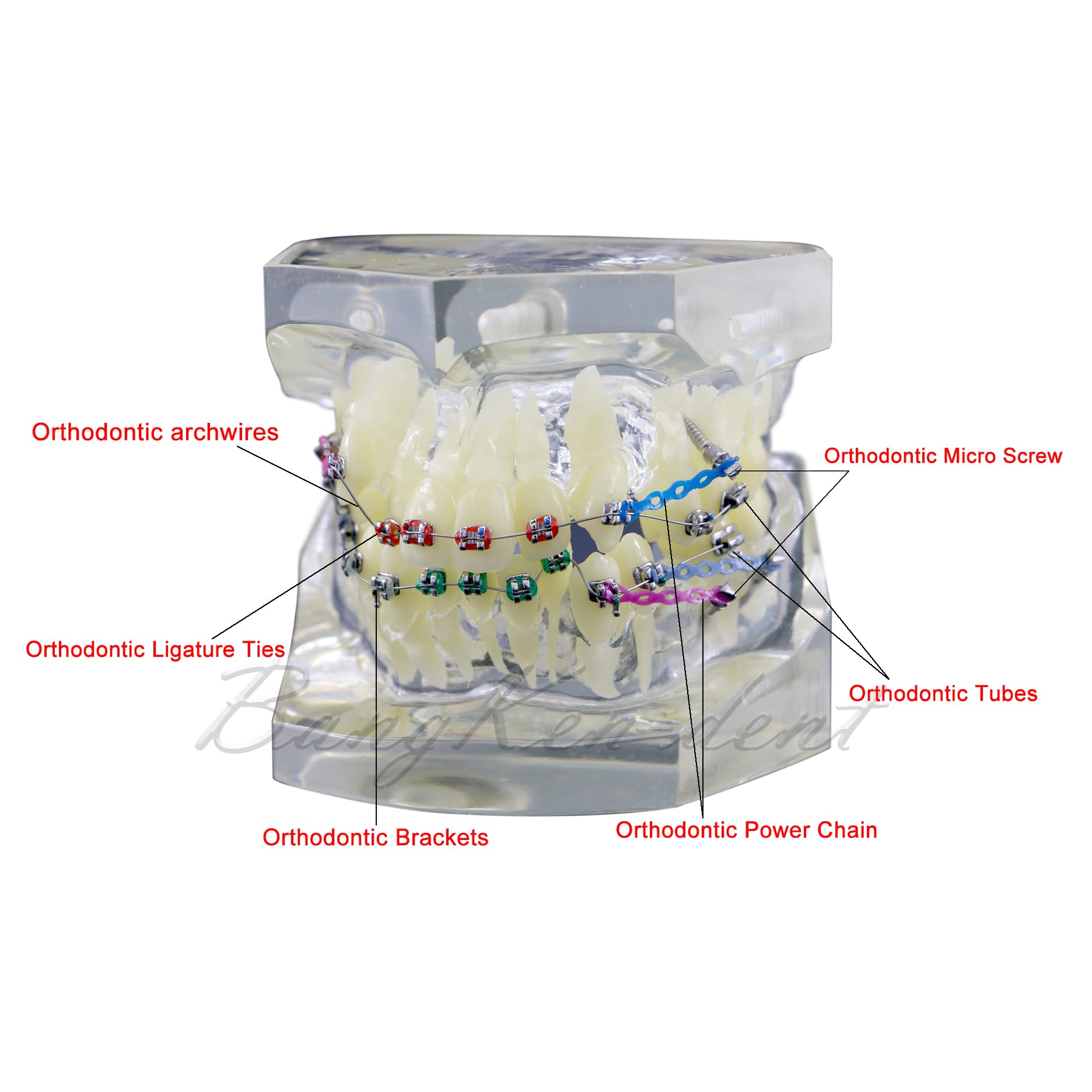 Orthodontic Typodont Dental Model with Braces, Arch Wire, Bracket & Buccal Tube - Premolar Deformity Teaching Demonstration Kit for Dental Students & Professionals (M3005-CLEAR) - Perfect for Dental School Practice, Orthodontic Training & Clinical Demonstrations