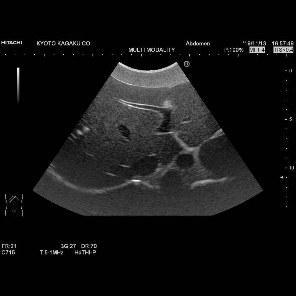 Dual Modality Human Abdomen Phantom for CT and Ultrasound Imaging - Ideal for Medical Training, Diagnostic Practice, and Radiology Research