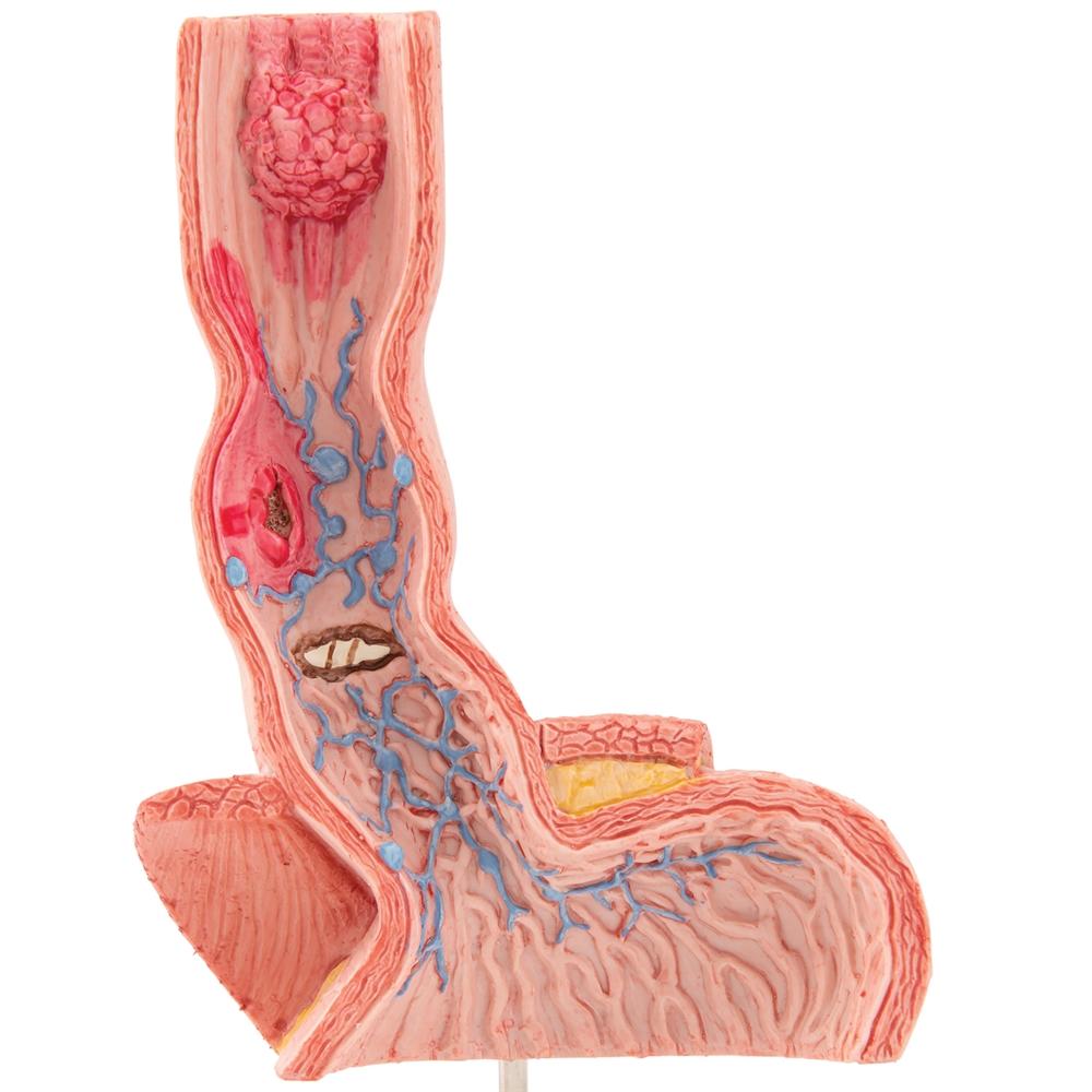 Human Esophagus Anatomy Model - Detailed Medical Teaching Tool for Digestive System Study | Ideal for Students, Doctors & Healthcare Professionals