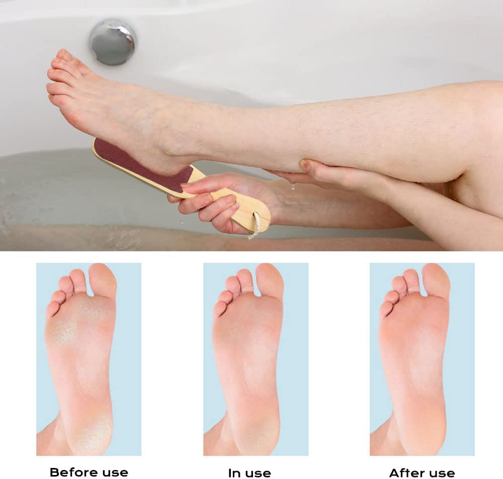 Double Sided Pumice Stone Foot File with Wooden Handle - Callus Remover & Foot Care Tool for Pedicure, Dry & Cracked Heels - Perfect for Home Spa & Professional Salon Use