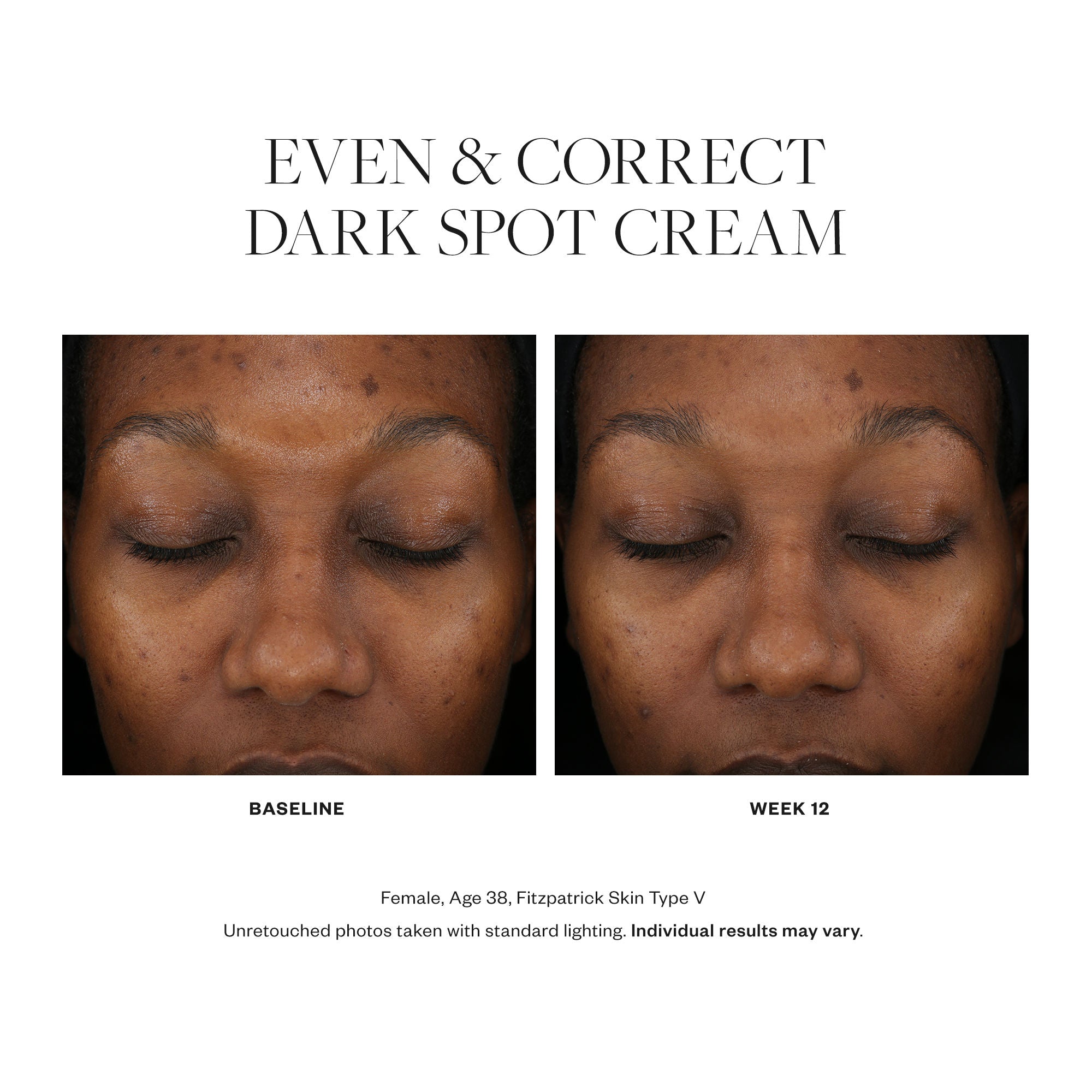 Even & Correct Dark Spot Cream - Brightening & Hydrating Face Treatment for Hyperpigmentation, Melasma & Sun Spots | Perfect for Daily Skincare Routine & Nighttime Use