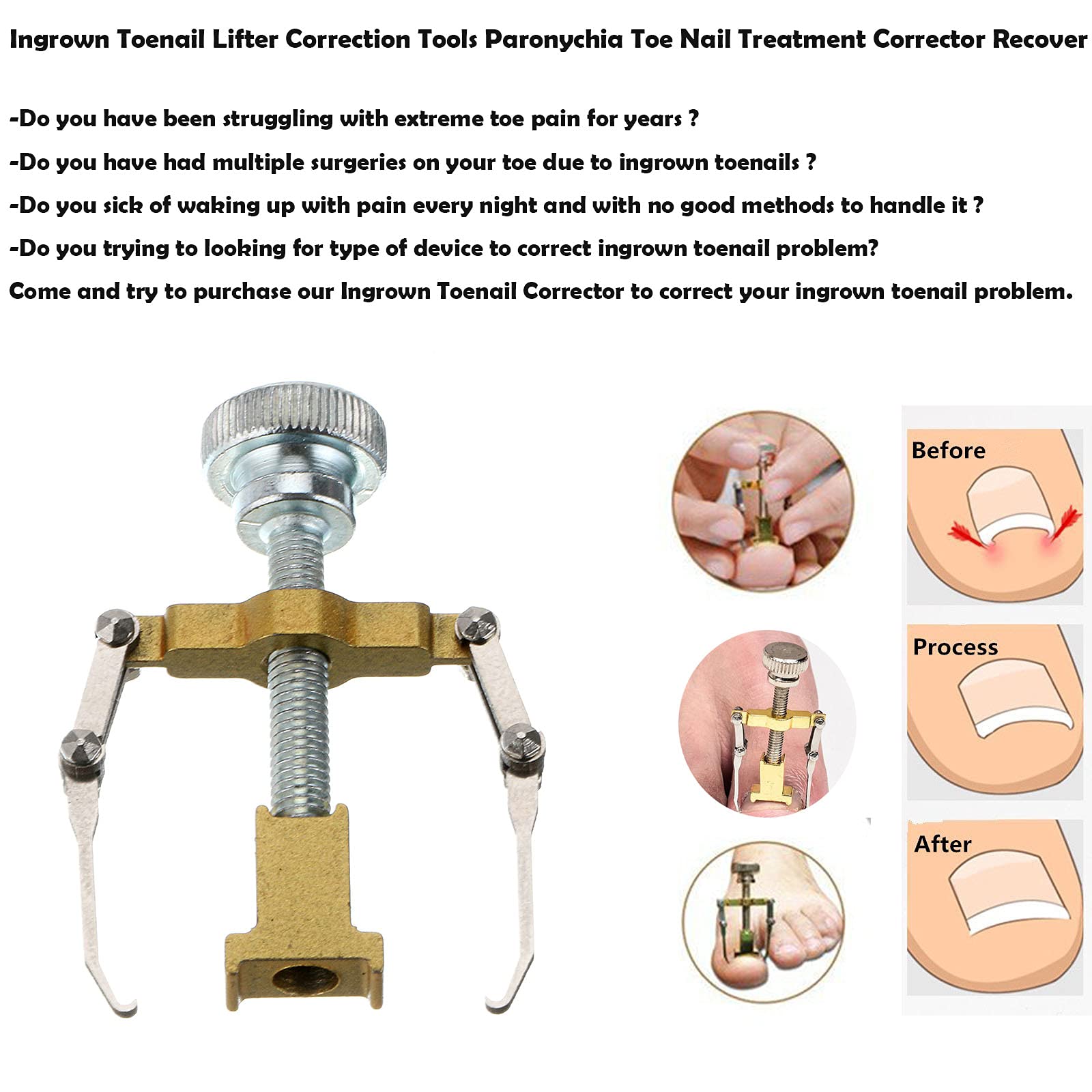 Ingrown Toenail Corrector & Pedicure Tool - Double Sided Nail Lifter for Toenail Care, Orthotic Nail Fixer - Perfect for Ingrown Toenail Treatment & At-Home Pedicures