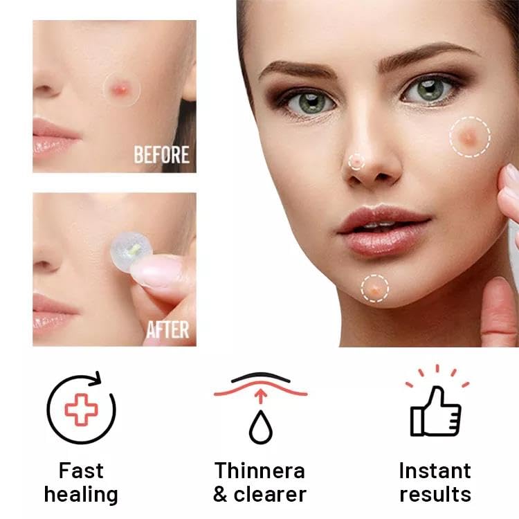 Tristar Beauty Magic Acne and Pimple Cover Patches - 48 Count Invisible Spot Treatment for Face, Blemishes & Breakouts | Perfect for Overnight Use, Travel & Daily Skincare Routine
