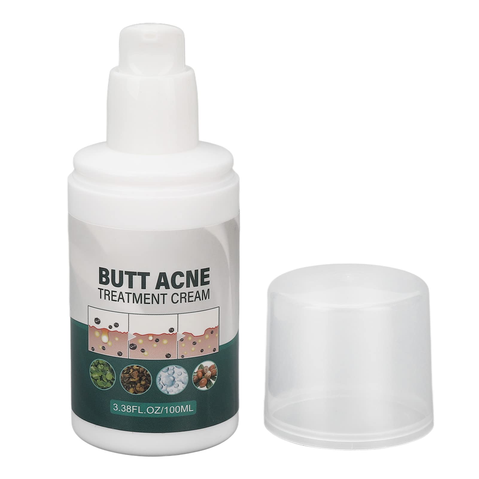 Best Buttock Pimple Treatment Cream - Acne Cleansing & Skin Moisturizing Repair for Thigh & Butt Area | Prevent & Soothe Breakouts for Smooth Skin | Perfect for Post-Workout, Travel & Daily Care