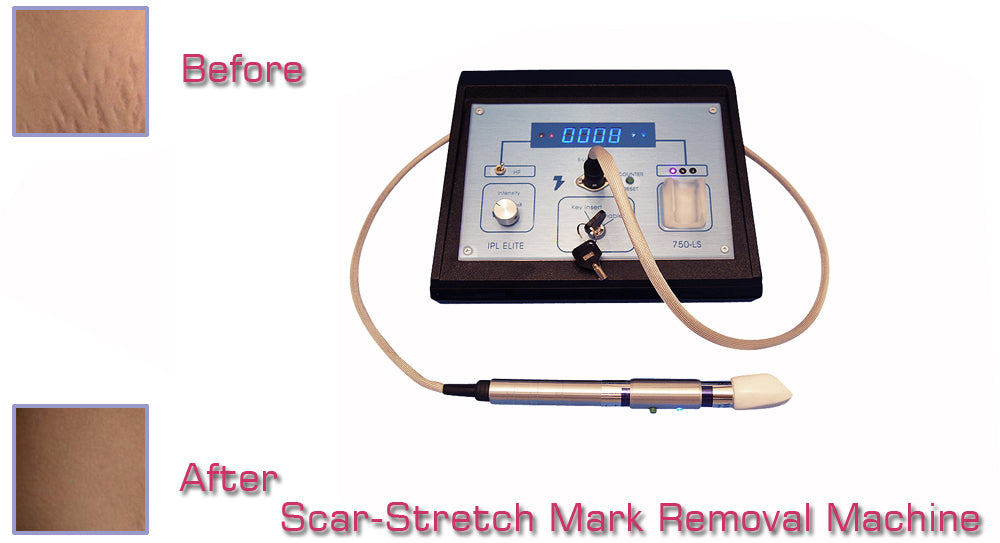 Professional Scar & Stretch Mark Removal Machine - Home & Salon Therapy System for Men & Women | Post-Surgery Recovery, Pregnancy Care & Skin Rejuvenation Treatment