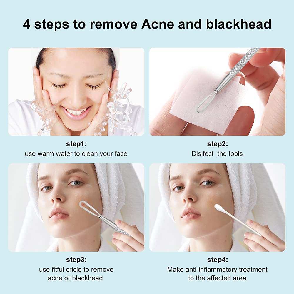 KIRA 2-in-1 Stainless Steel Pimple & Blackhead Remover Tool - Comedone Extractor for Acne Prone Skin (Men & Women) - Silver (Pack of 1) | Perfect for Home Skincare Routine & Travel Beauty Kit