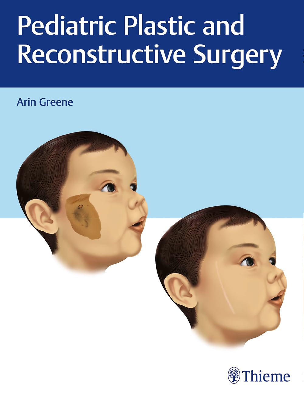 Pediatric Plastic and Reconstructive Surgery - Expert Care for Children's Congenital & Acquired Deformities | Craniofacial, Hand, and Burn Reconstruction | Ideal for Birth Defects, Trauma Recovery, and Cosmetic Corrections