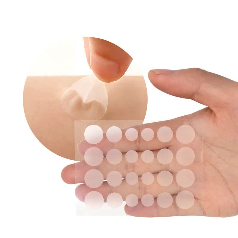 Mluffy 36Pcs Invisible Acne Pimple Patches - Hydrocolloid Spot Treatment Stickers for Face, Absorbing Blemish & Scar Care, Waterproof Transparent Pimple Patch Sheets for Clear Skin (Pack of 1) | Perfect for Overnight Spot Treatment, Teen & Adult Acne Care, Travel-Friendly Skin Solution