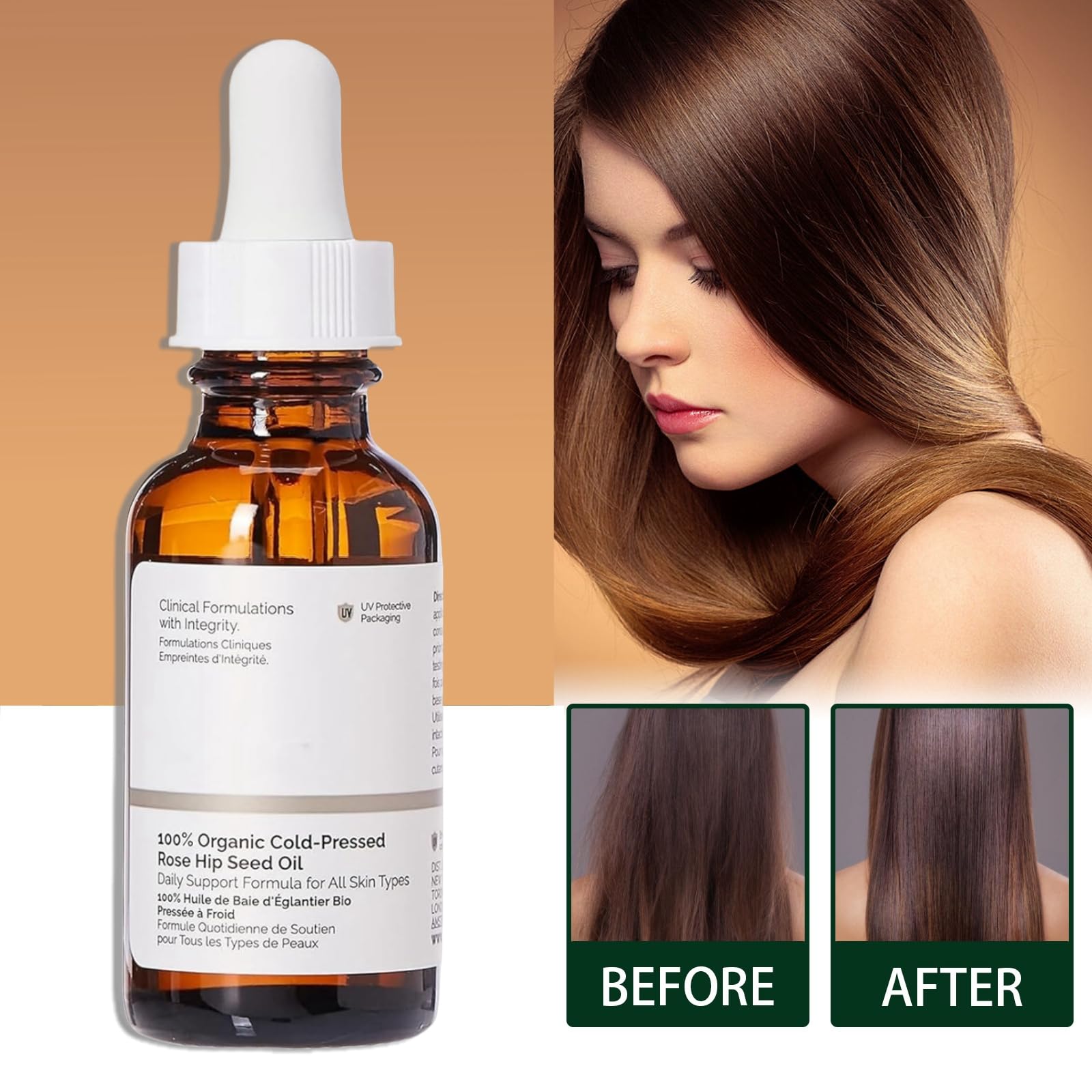 100% Pure Organic Rosehip Seed Oil for Face & Skin - Anti-Aging Serum, Moisturizer for Women - Natural Rose Essential Oil for Hair, Nails & Body Care - Perfect for Night Routine, Dry Skin Treatment & DIY Beauty Recipes