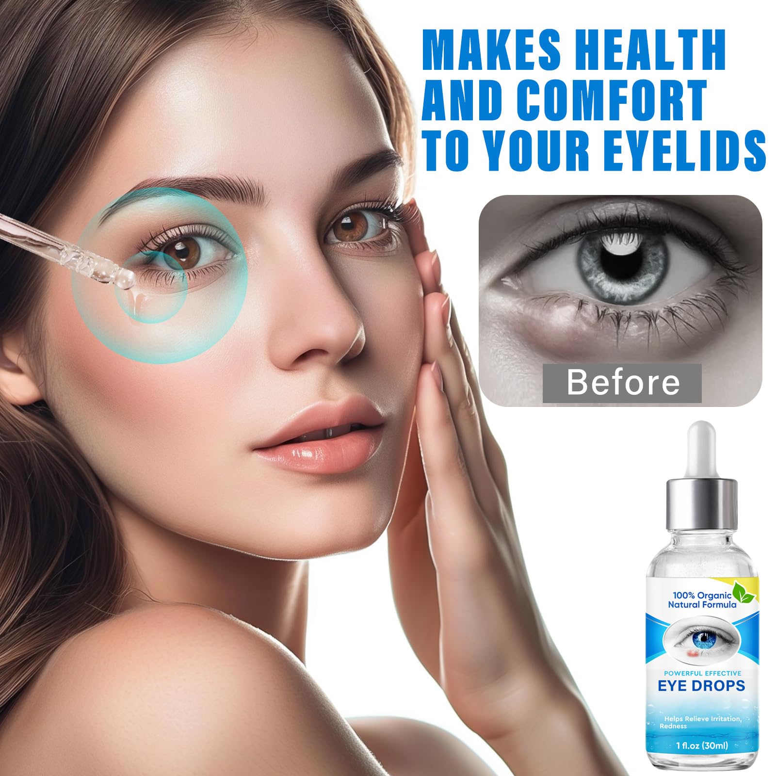 Stye Eye Treatment Serum for Styes, Chalazion & Blepharitis | Gentle Lash & Eye Cleanser (30ml) | Soothes Irritation & Promotes Healing | Perfect for Daily Eye Care & Eyelid Hygiene