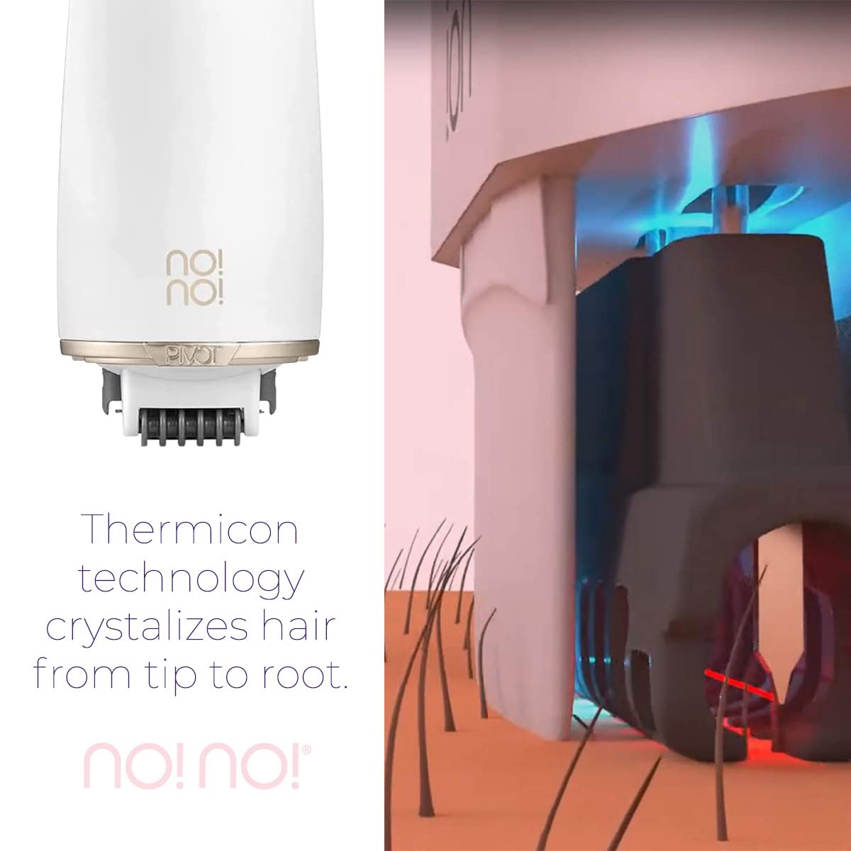 No!No! Pivot Ultimate Hair Removal System - Painless & Effective for Face & Body | Long-Lasting Semi-Permanent Results | Perfect for Home Use & Travel