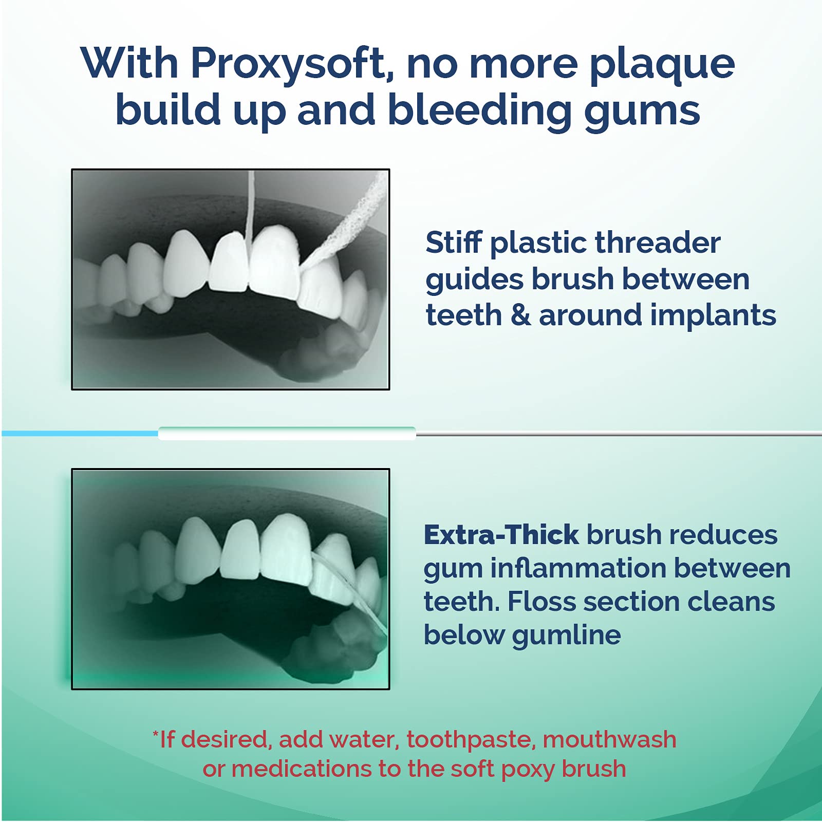**ProxySoft Periodontal Floss, 2 Packs - Dental Floss Threader for Braces & Teeth, Thick ProxyBrush for Gum Health & Periodontal Care - Orthodontic Flossers for Daily Oral Hygiene - Perfect for Braces, Bridges, and Dental Implants**