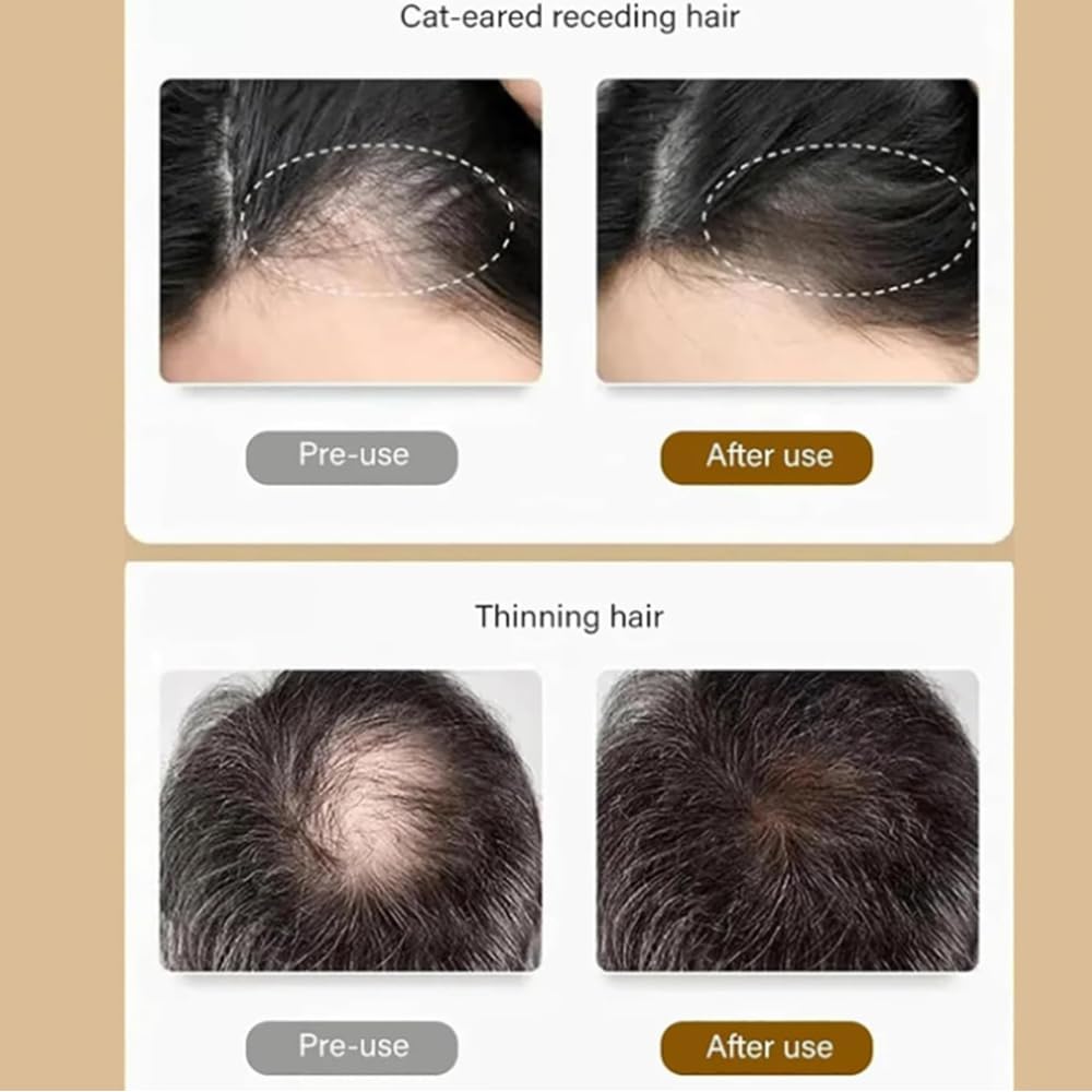 Premium Caviar Amino Acid Shampoo for Damaged Hair - Deep Sea Protein Treatment, Anti-Dandruff & Hydrating Formula for Smooth, Shiny Hair (2-Pack) - Perfect for Daily Hair Care & Salon-Quality Results at Home