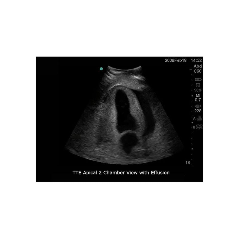 FAST Exam Ultrasound Training Model - Transthoracic & Transesophageal Echo Simulator for Cardiac Sonography Practice (Ideal for Medical Students, Ultrasound Tech Training & Clinical Skills Development)