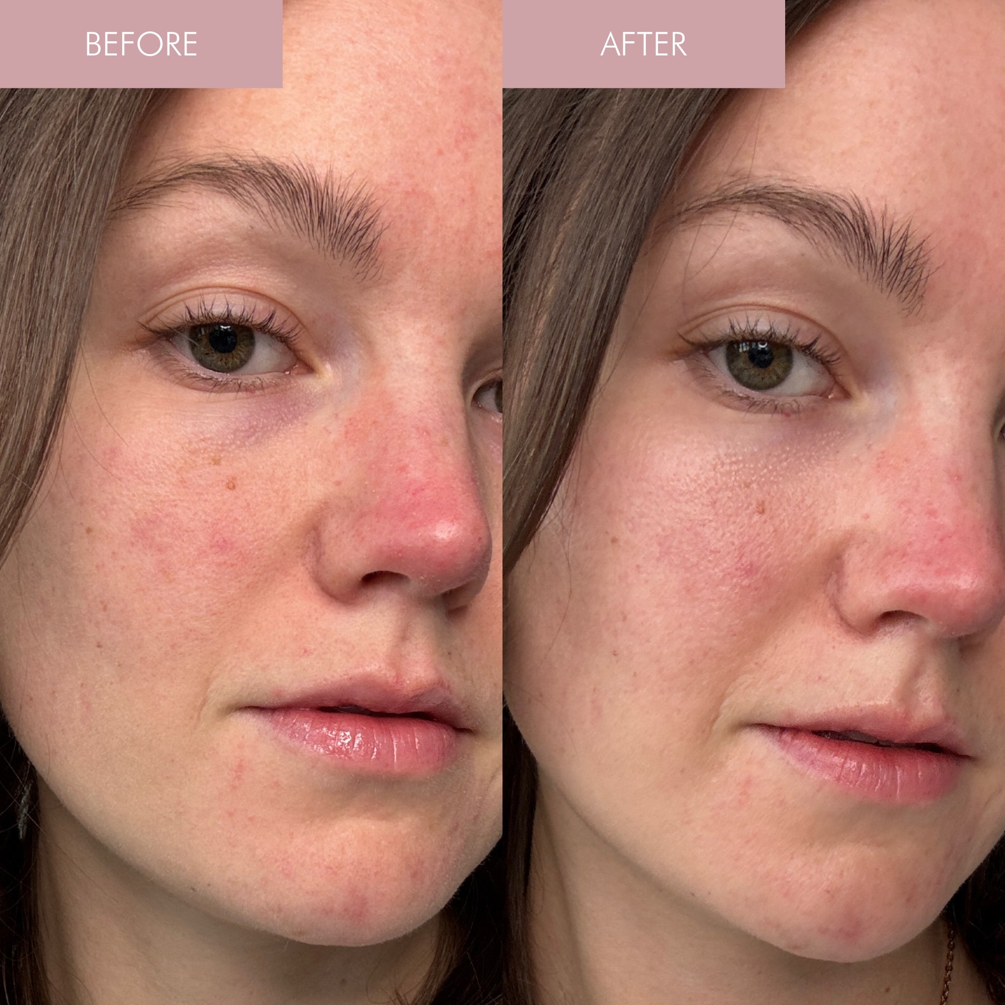 Pearl Peptide Glaze Facial Essence - Hydrating & Brightening Skin Care for Glowing Complexion | Perfect for Daily Skincare Routine & Nighttime Hydration