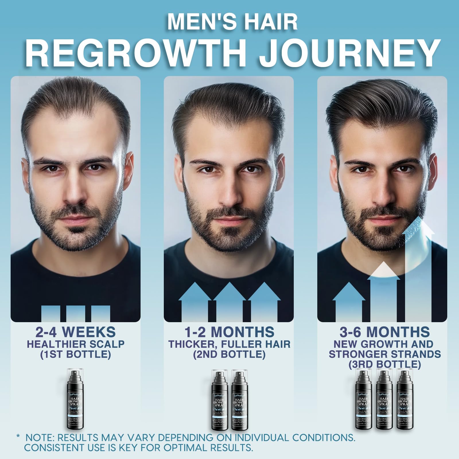 Natural Hair Growth Spray for Men - Rosemary, Batana Oil, Rice Water & Biotin Serum | Scalp Treatment with Castor Oil & Caffeine | Hair Thickening & Hair Loss Solution (60ml) | Perfect for Daily Use & Styling Routine