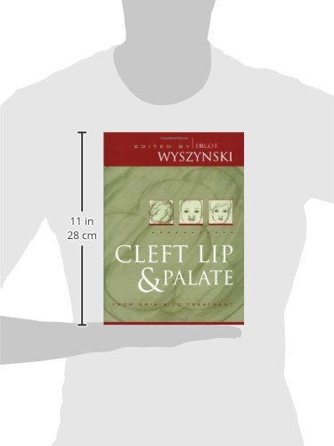 Cleft Lip and Palate Treatment Guide - Causes, Surgery & Recovery for Babies & Adults | Home Care & Feeding Tips