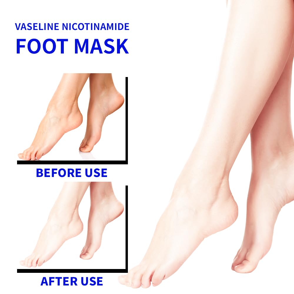 ROUSE Moisturizing Foot Mask Socks - 6 Pack Hydrating Spa Treatment for Dry & Cracked Feet - Nicotinamide, Shea Butter & Goat Milk - Softening Care for Women & Men - Perfect for Home Pedicure & Relaxation
