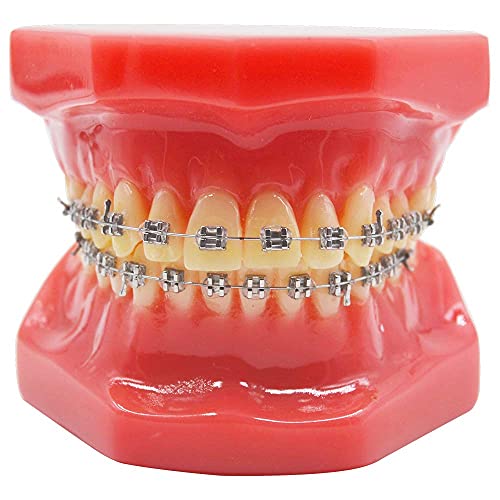 Orthodontic Metal Bracket with Typodont Teeth Model - Dental Training Kit for Students, Dentists & Patients | Ideal for Teaching, Studying & Clinical Demonstrations