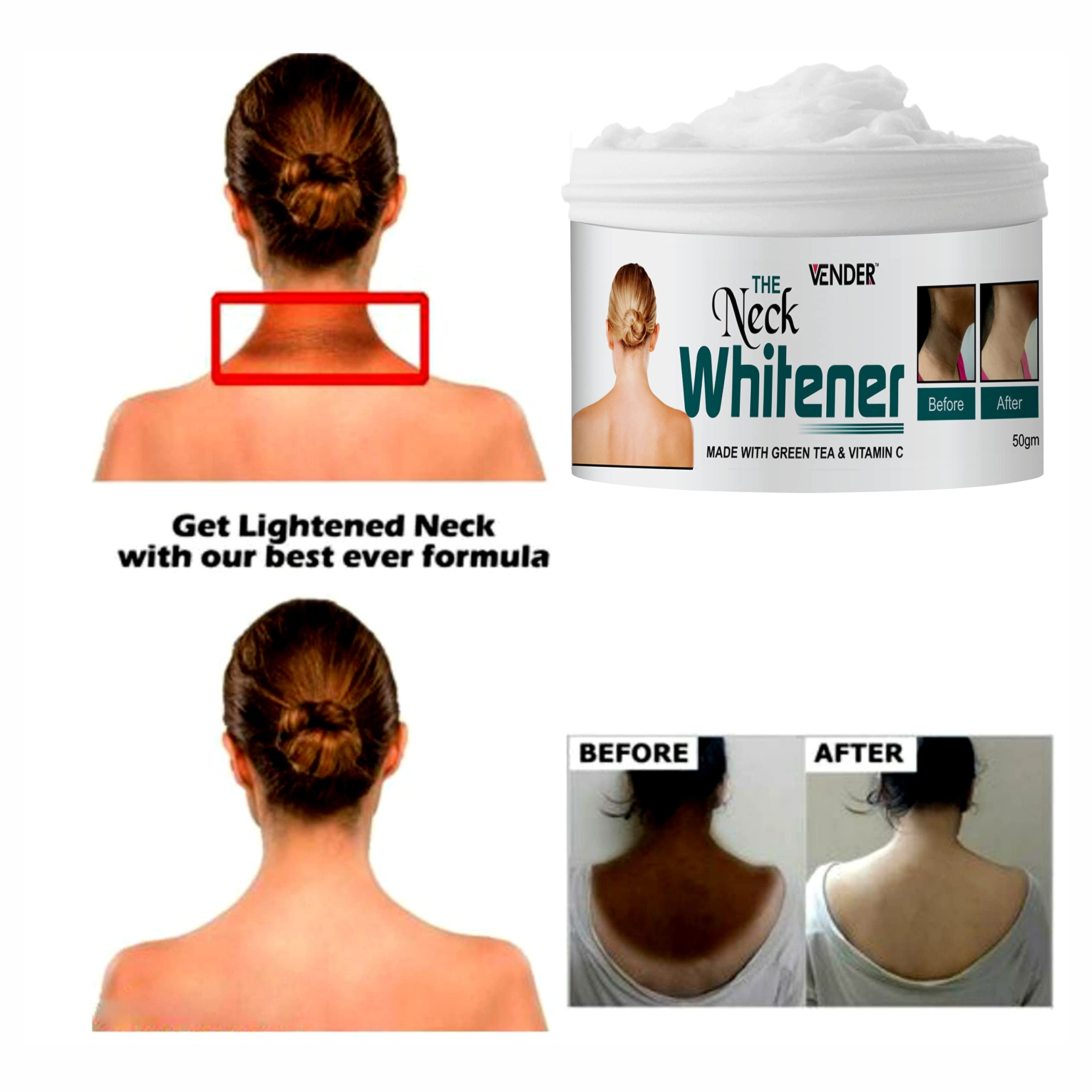 Best Green Tea & Vitamin C Brightening Cream for Dark Neck, Knees & Elbows - 50g | Hydrating & Lightening Skin Care for Hyperpigmentation | Perfect for Daily Use & Night Routine