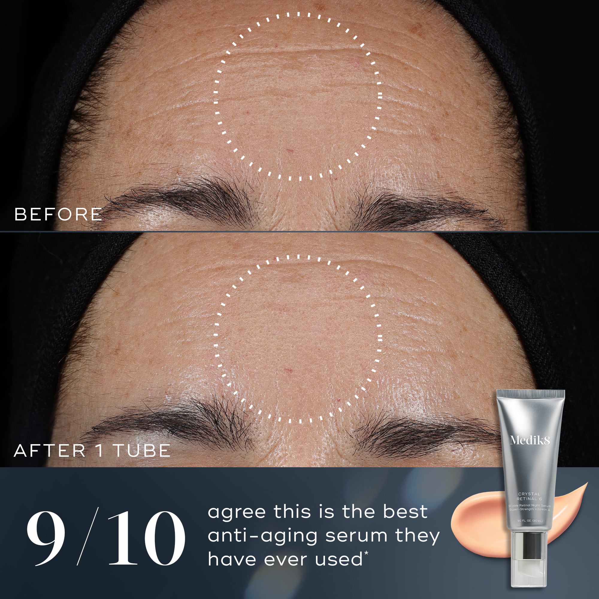 Professional Crystal Retinal Serum for Anti-Aging & Skin Rejuvenation | Vitamin A Skincare Treatment for Fine Lines & Wrinkles | Perfect for Nighttime Routine & Dermatologist Recommended