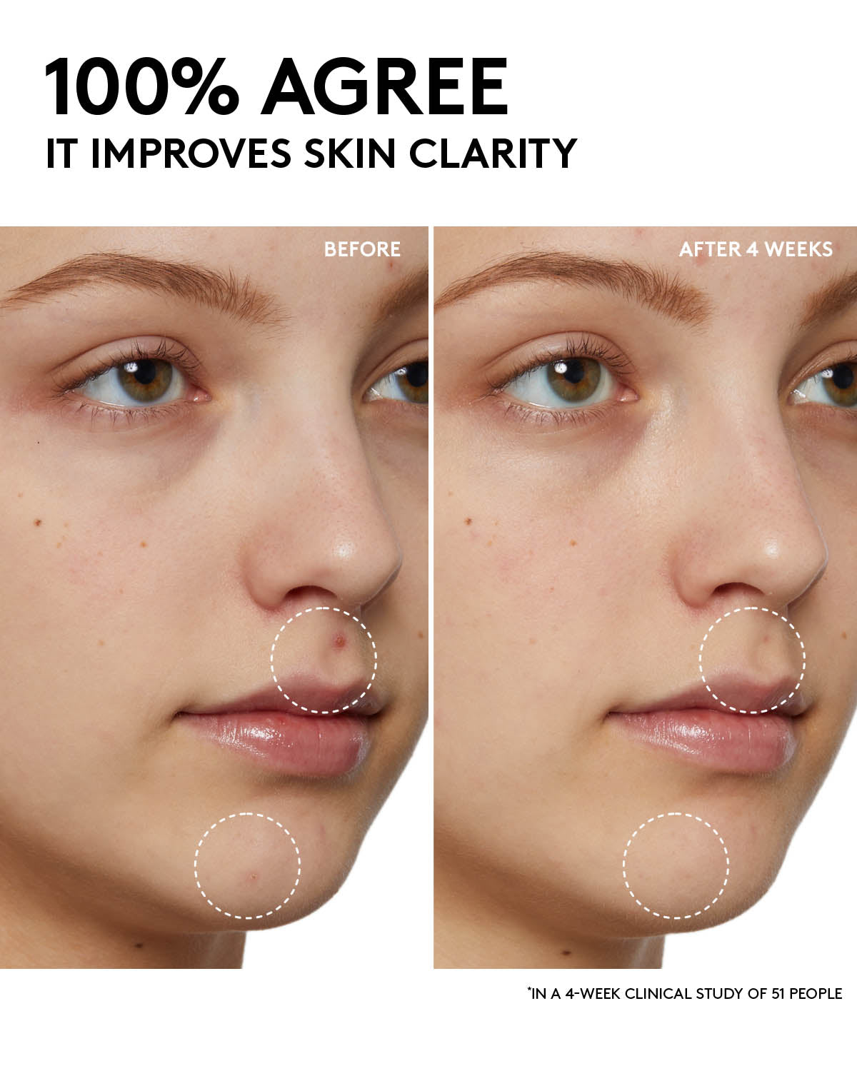 Cherry Dub Pore Purifying Gel Cleanser with Niacinamide & Aloe Juice - Deep Cleansing Face Wash for Oily & Acne-Prone Skin - Perfect for Daily Skincare Routine