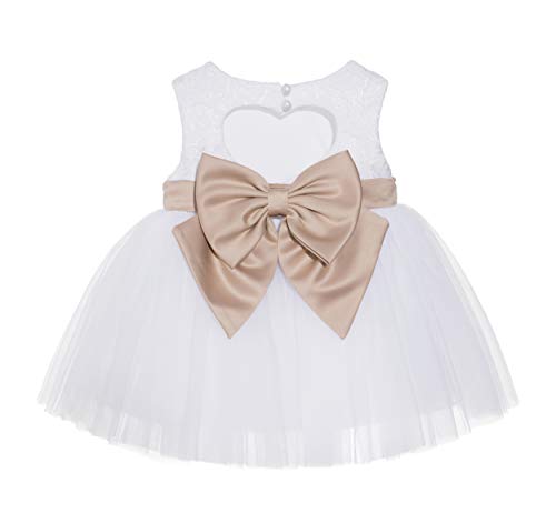 White / Rose Gold