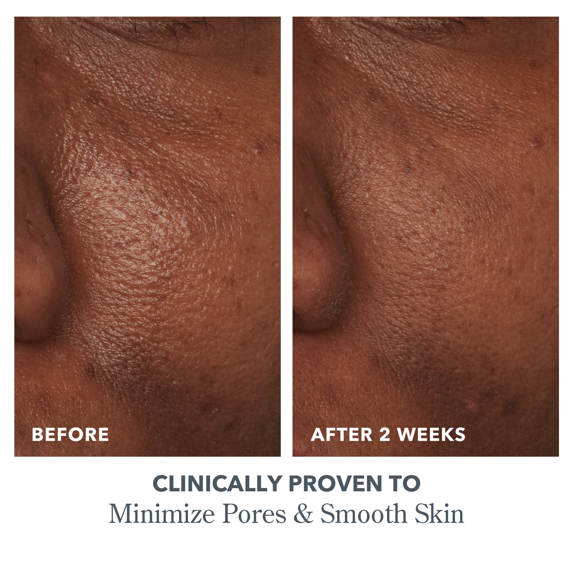Peel & Glow Bundle - Brightening Facial Mask & Exfoliating Treatment for Glowing Skin | Perfect for Nighttime Skincare Routine & Pre-Makeup Prep