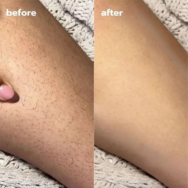 Pure Organic Cyperus Rotundus Oil for Hair Removal - 100% Natural & Effective Body Hair Growth Reduction - 2PCS Set - Perfect for Smooth Skin Care & DIY Beauty Treatments