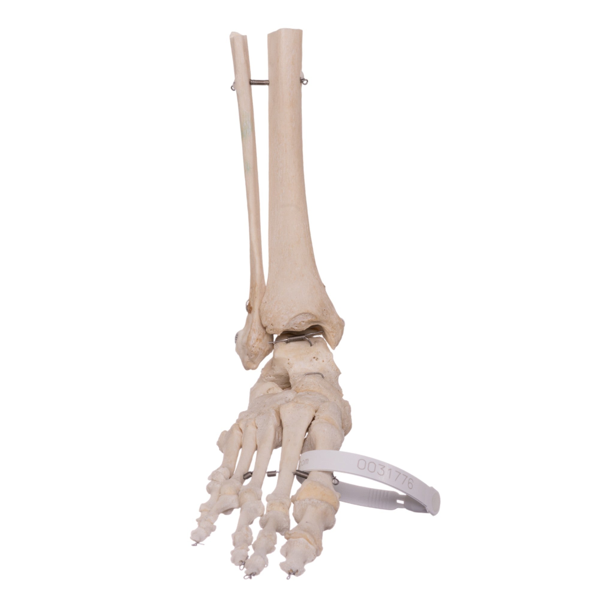 Authentic Human Right Foot with Partial Tibia and Fibula - Ideal for Medical Study, Anatomy Education & Forensic Training