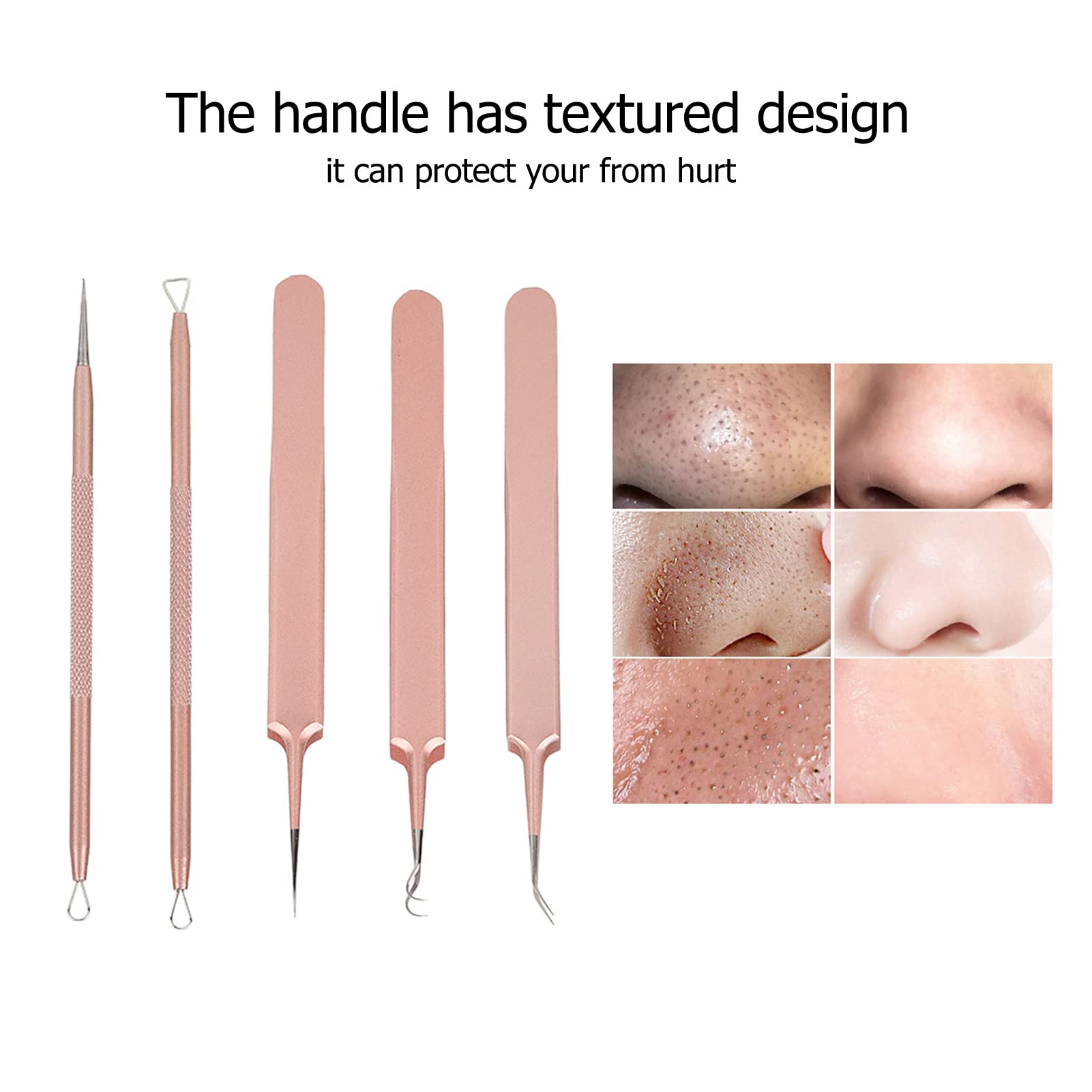 EXCLUZO Professional Pimple Extractor Needles Kit - Stainless Steel Blackhead & Whitehead Remover, Non-Slip Pore Cleaner Tools for Acne Treatment (Rose Gold) - Perfect for Home Skincare & Facial Care Routine
