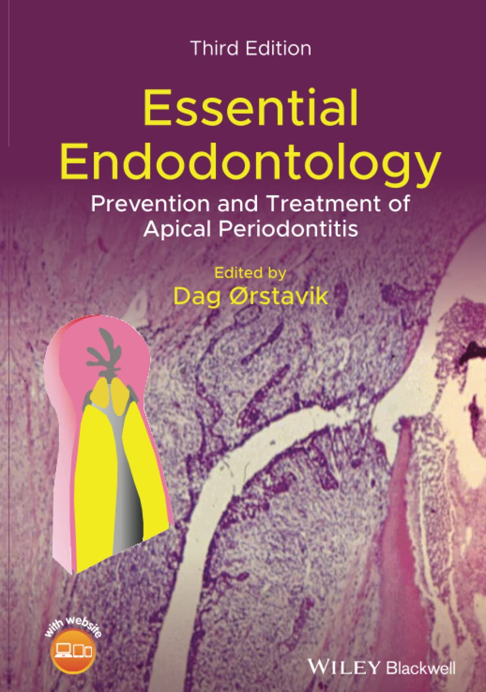 Essential Endodontology: Prevention and Treatment of Apical Periodontitis - Dental Root Canal Guide for Dentists & Students | Clinical Practice & Patient Care