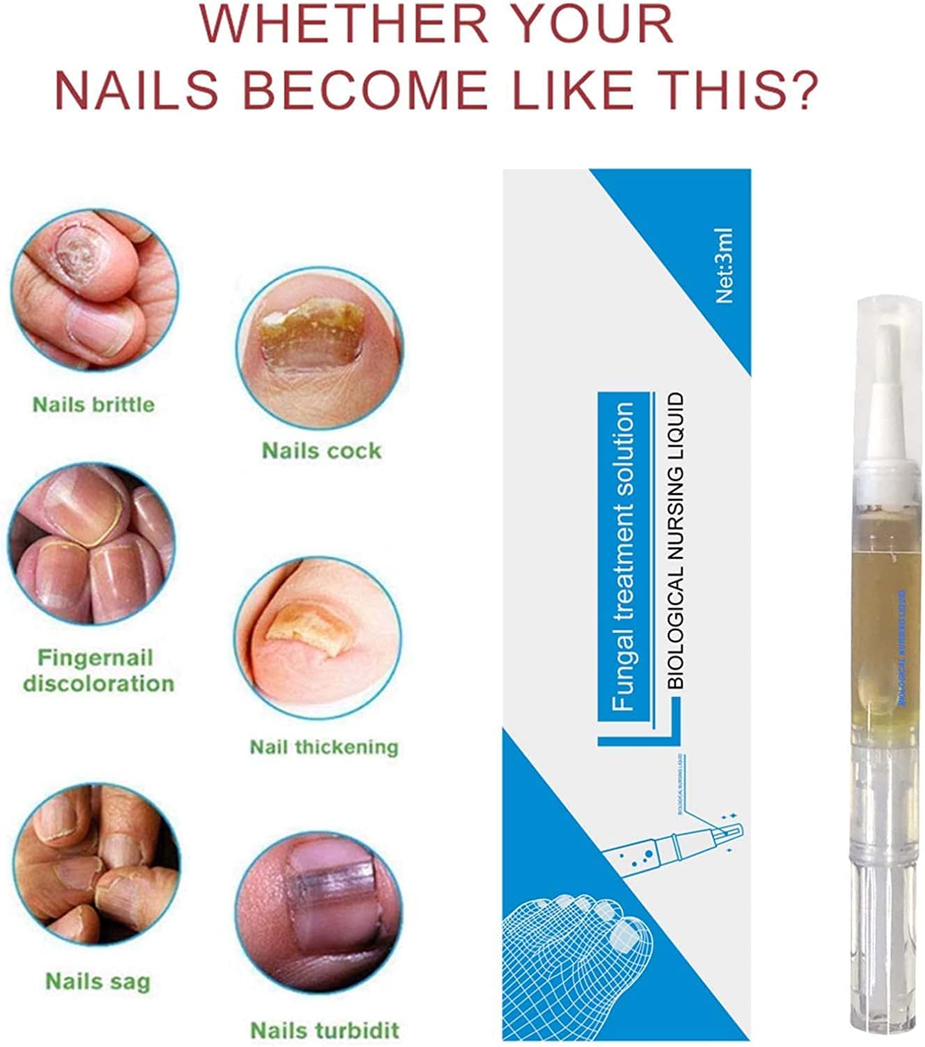 Okita Toenail Fungus Treatment Pen - Fast-Acting Antifungal Nail Repair for Toenails & Fingernails - Clinically Proven Fungus Eliminator (3 Pack) - Perfect for Athletes, Swimmers & Daily Foot Care