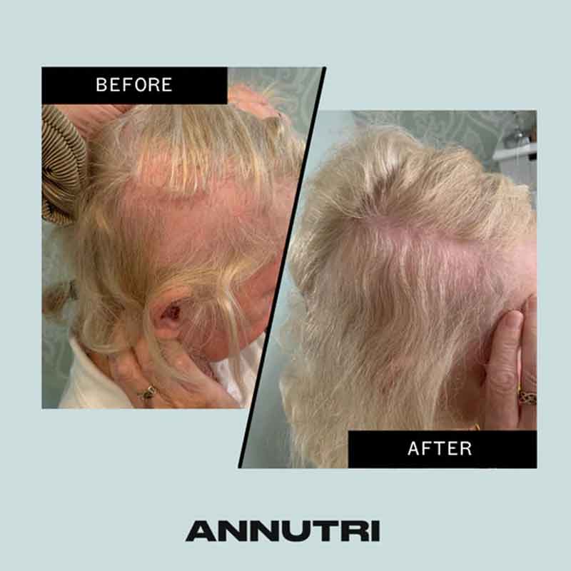 Annutri Grow It Hair Growth Supplement - 1 Month Supply for Thicker, Stronger Hair - Perfect for Men & Women with Thinning Hair or Hair Loss