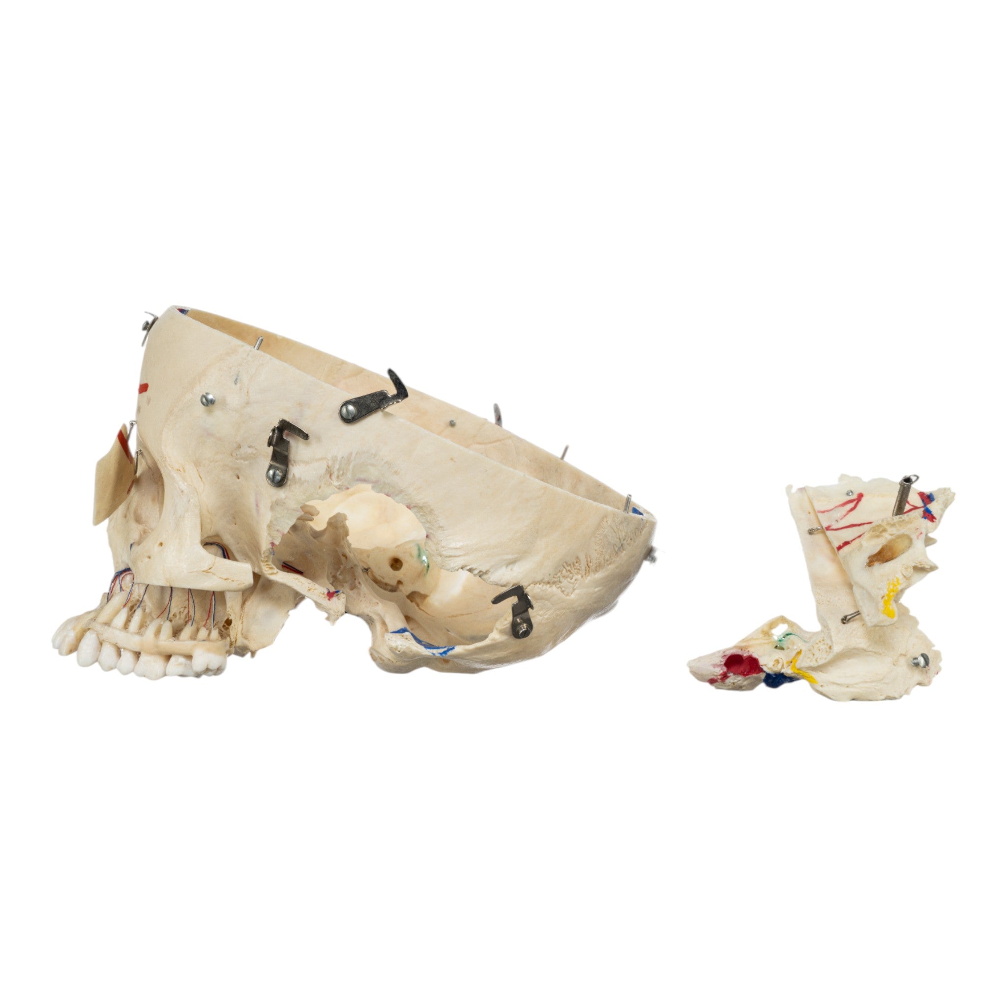 Authentic Real Human Skull for Medical Study - Perfect for Anatomy Education, Forensic Research & Halloween Decor
