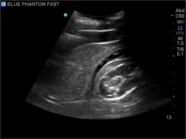 FAST Exam Real Time Ultrasound Training Model - Transthoracic Only for Emergency Medicine & Trauma Assessment Practice (Medical Simulation, Sonography Education, TTE Training)