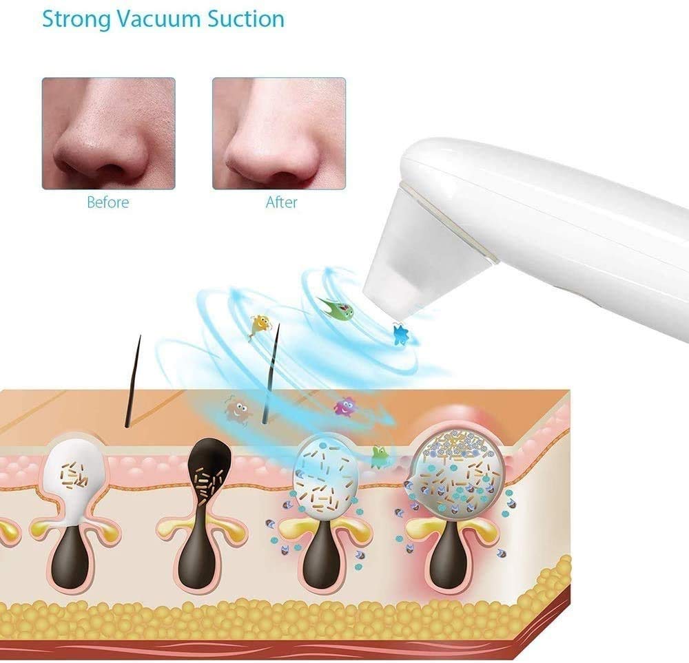 **Electric Blackhead Remover Pore Vacuum Cleaner - USB Rechargeable Facial Pore Cleaner for Acne, Comedones & Whitehead Removal | Perfect for At-Home Skincare & Spa Treatments**