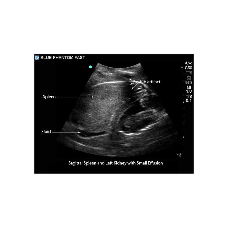 FAST Exam Ultrasound Training Model - Transthoracic & Transesophageal Echo Simulator for Cardiac Sonography Practice (Ideal for Medical Students, Ultrasound Tech Training & Clinical Skills Development)