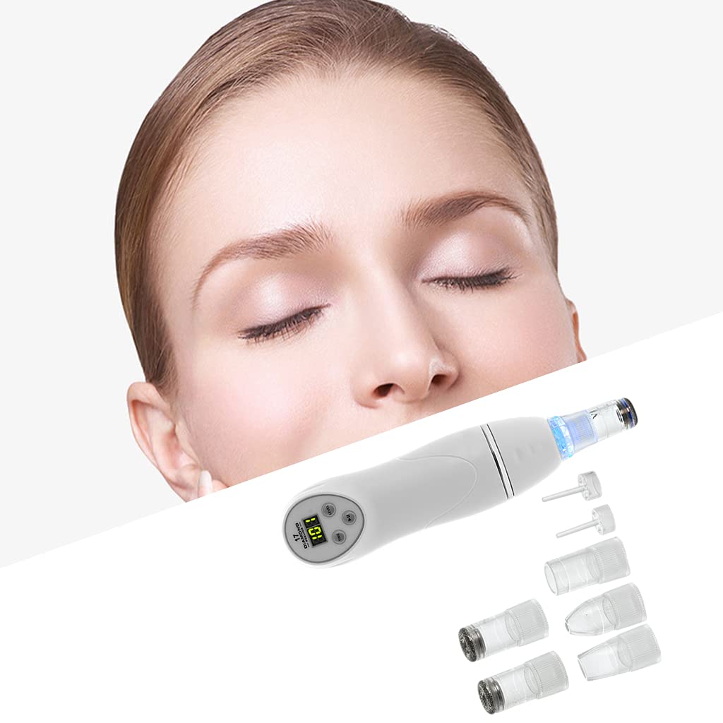Professional Losa Blackhead Remover Tool - Deep Cleansing Pore Vacuum for Face & Nose - Acne Extractor & Blackhead Suction Kit - Perfect for Daily Skincare & Spa Treatments