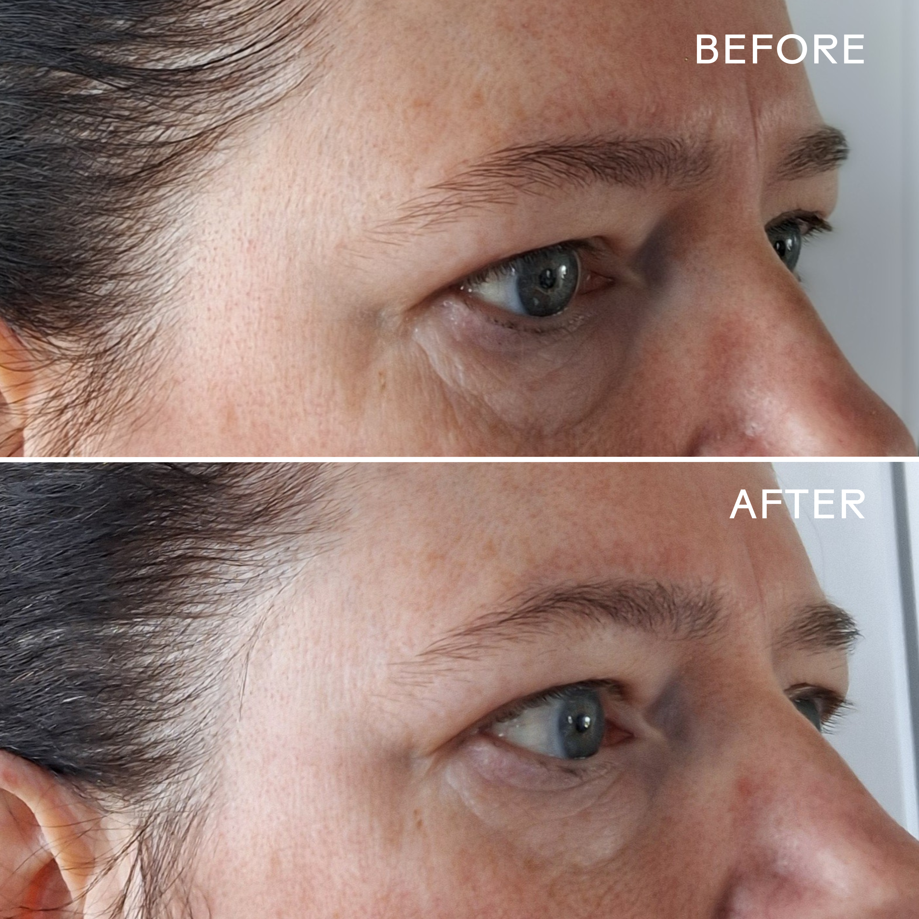 EyeHero™ Bio Retinol Smoothing Eye Cream - Anti-Aging & Wrinkle Reduction for Dark Circles & Puffiness - Perfect for Nighttime Skincare Routine & Travel